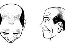 The Best Male Hair Loss Products