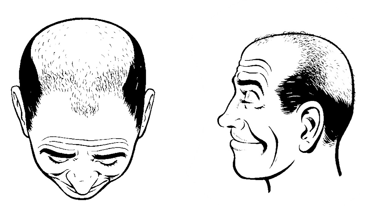 Best Hair Loss Cure for Men The Best Male Hair Loss Products