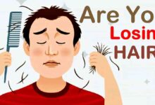 Here is Why You Are Losing Hair Hair Loss: These Are Reasons Why You Lose Hair